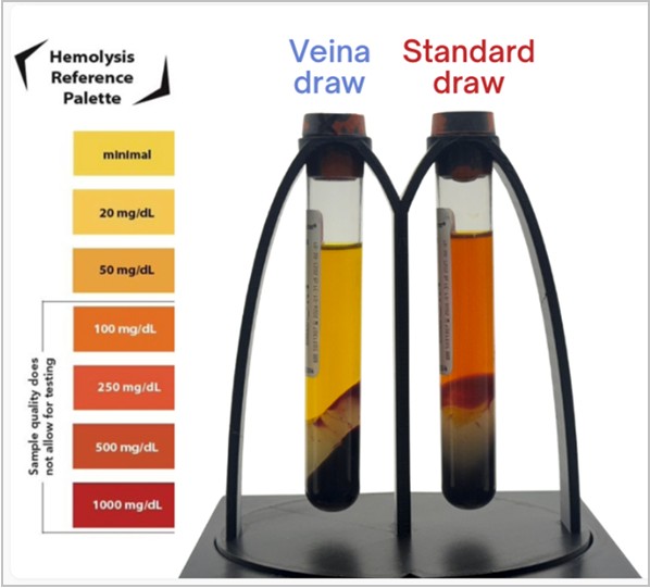 New Blood Collection Strategies Aim to Expand Supply of Donor Tissue for Cornea Transplants